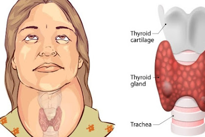 10 Signs You Have a Thyroid Problem and 10 Ways to Deal With It 