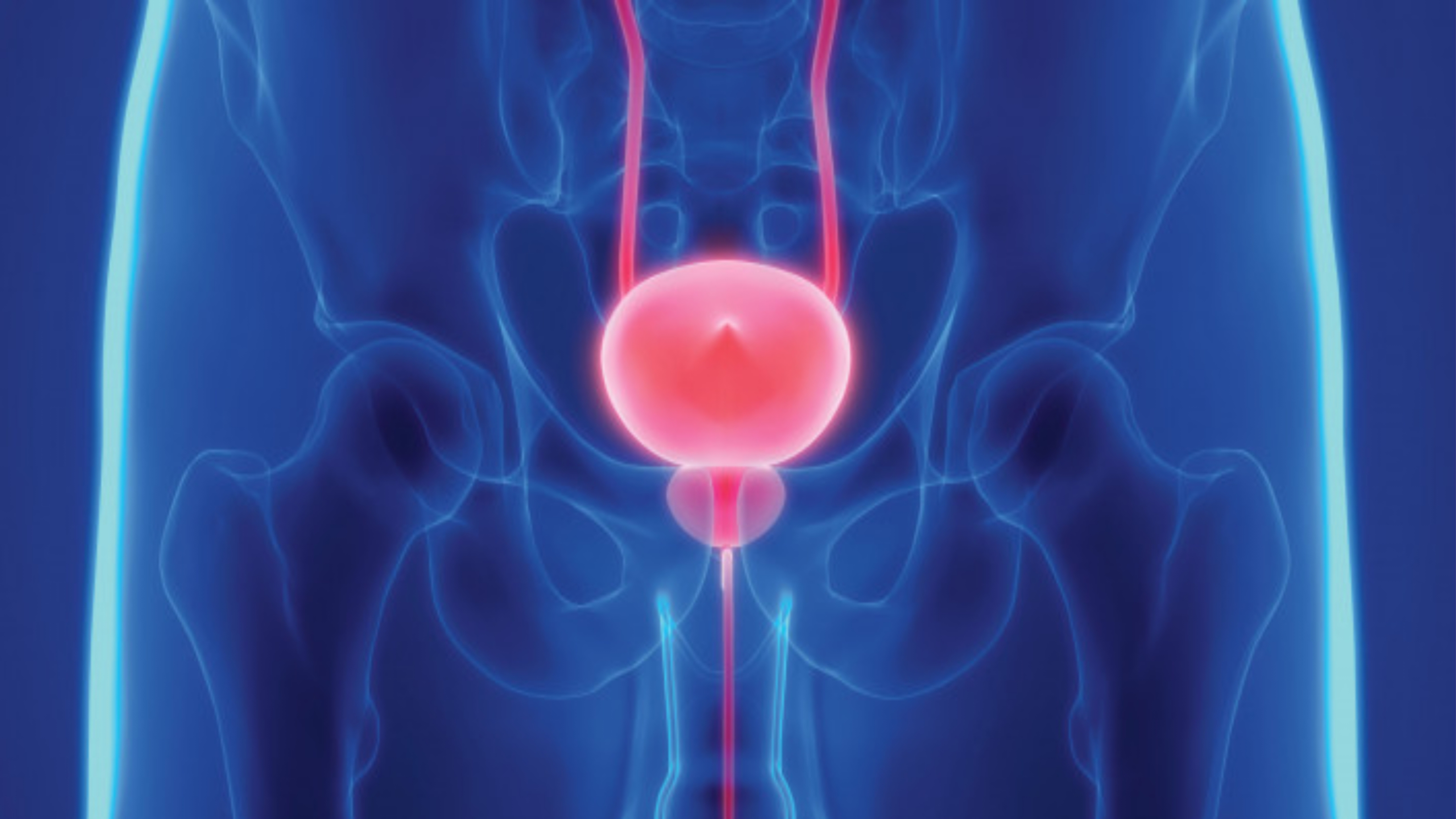 https://www.healthandfitnessexpert.in/2024/05/what-is-prostate-cancer.html