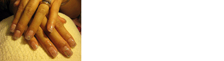 BannerAd