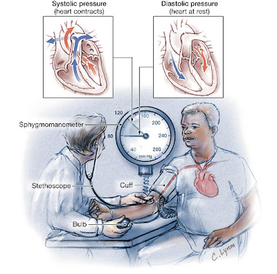 Hypertension  high blood pressure: what is hypertension