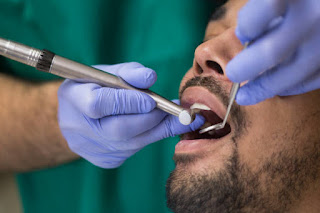 أفضل طبيب أسنان في الكويت - أقوى عيادة اسنان - Best Dental Clinic Kuwait