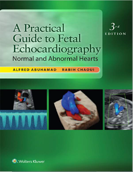 A Practical Guide to  Fetal Echocardiography