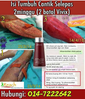 Testimoni Vivix : Isi Tumbuh Cantik Selepas 2 Botol Vivix