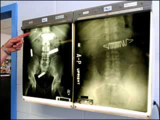 Unbelievable X-rays (12) 8