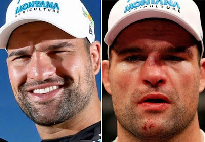 UFC Fighters Before And After A Fight