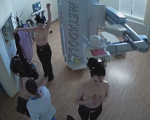 Women on X-ray examination without bras SpyCam (X-ray Examination 23-25)