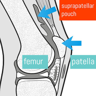 voodoo floss knee suprapatellar pouch