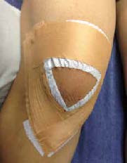 Deloading Tape Demonstration - El Paso Chiropractor