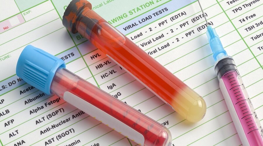 Chỉ số HbA1c là gì 1