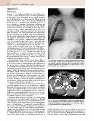 Ashcraft's Pediatric Surgery