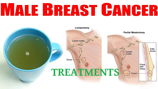 Most Effective Male Breast Cancer Treatments