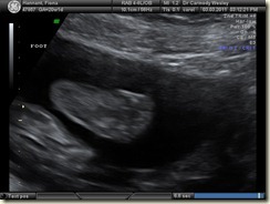 BABY_19
