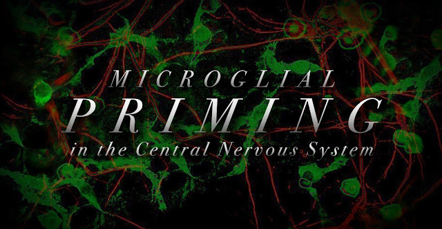 Microglial Priming in the Central Nervous System | El Paso, TX Chiropractor