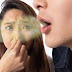 Never ignore bad breath, otherwise serious illnesses can occur