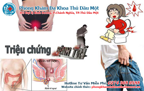 So sánh giữa bệnh trĩ và bệnh sùi mào gà ở hậu môn