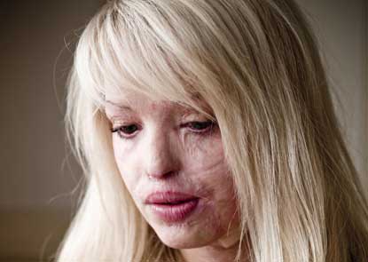 Look At Her Beautiful Face: Don't Overlook KATIE PIPER's Beauty