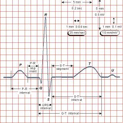 Videos de Electrocardiografia