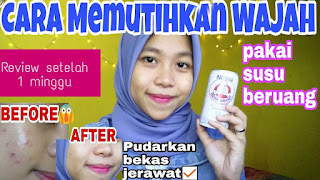  Ada berbagai tips untuk membuat kulit putih secara alami Cara Memutihkan Kulit Dengan Susu Beruang Dan Bahan Alami Lainnya