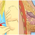 Ayo Bantu Sebarkan..!! Wanita Perlu di Catat! Benjolan Seperi Inilah yang Menjadi Ciri-ciri Kanker Payudara, Pastikan Kamu Langsung Cek Setelah Membaca !