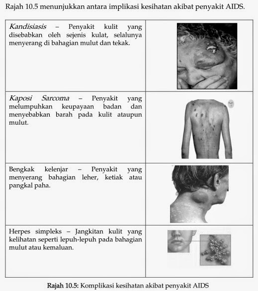 My Note Blog: TOPIK 10 PENDIDIKAN PENCEGAHAN HIV/AIDS