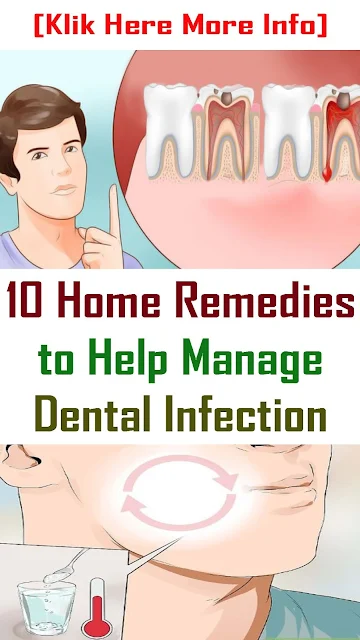 Tooth Abscess: 10 Home Remedies to Help Manage the Infection