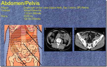 ABDOMEN PELVIS