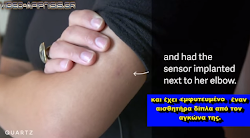  Γυναίκα έχει τσιπάκι αισθητήρα σεισμών στο χέρι της.... Ο αισθητήρας συνδέεται μέσω διαδυκτίου με έναν σεισμογράφο που καταγράφει όλους του...