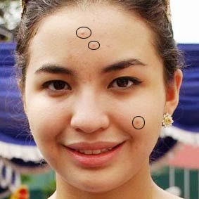 Menghilangkan Jerawat Dengan Photoshop