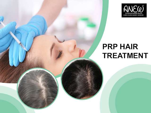 PRP Hair Treatment in Goa