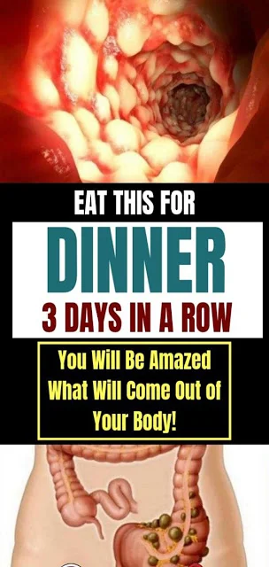 Eat This for Dinner 3 Days in a Row. You Will Be Amazed What Will Come Out of Your Body