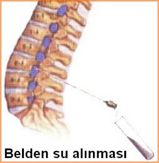 belden su alınması