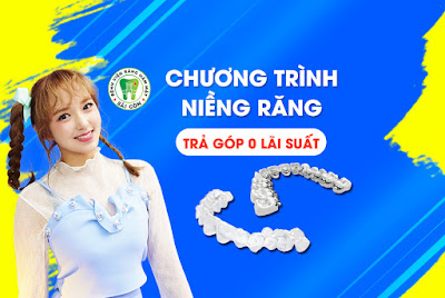 nieng-rang-tra-gop