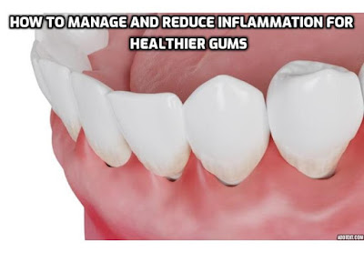 Gum inflammation, also known as gingival inflammation, can cause discomfort and signal an underlying oral health issue. It's crucial to address gum inflammation promptly to prevent further complications. How to manage and reduce gum inflammation for healthier gums.