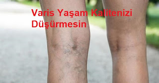 Varis Yaşam Kalitenizi Düşürmesin