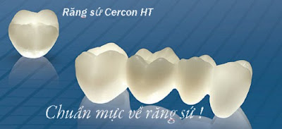 Tại sao răng sứ Cercon lại được nhiều người lựa chọn?