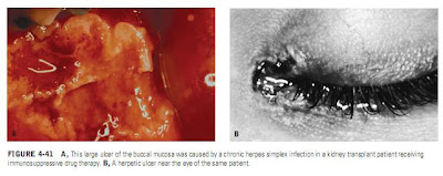 THE PATIENT WITH SINGLE ULCERS