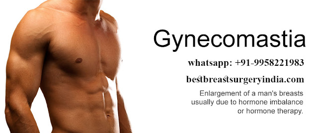 gynecomastia surgery in delhi