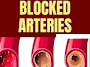 Here Are 7 Warning Signs You Have Blocked Arteries 