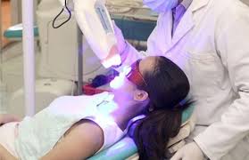Tẩy trắng răng bằng đèn plasma hoàn toàn an toàn với sức khỏe