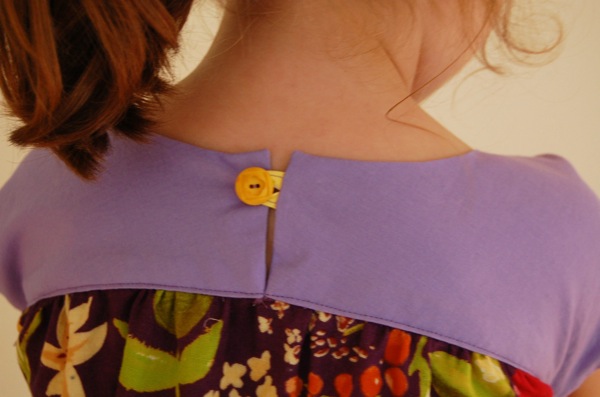 button