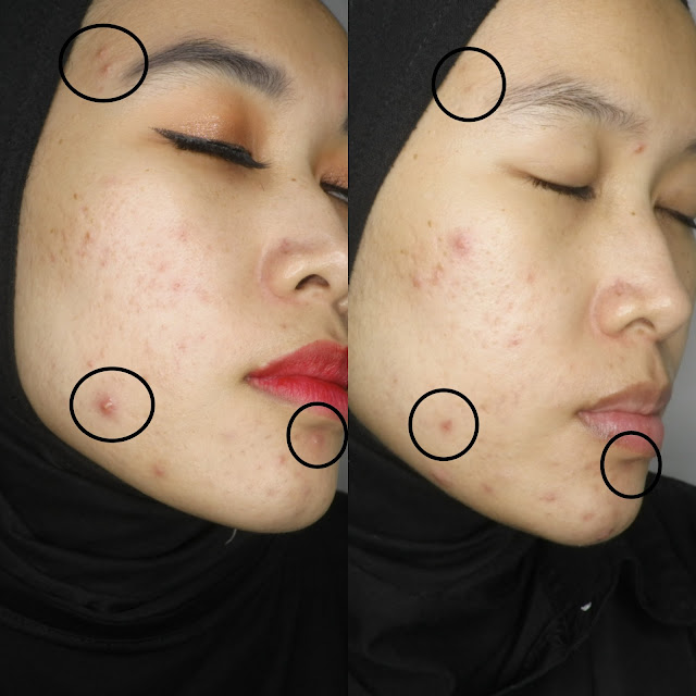 Review-Chiyou-Skin-Result
