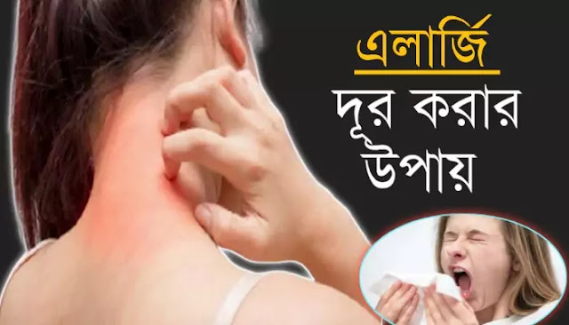 এলার্জি দূর করার ঘরোয়া ২০ টি উপায়