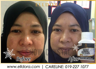 Elldora Snow Crystal, elldora, snow crystal, kebaikkan snow crystal, kelebihan snow crystal, keistimewaan snow crystal, kandungan snow crystal, cara beli elldora snow crystal, testimoni elldora snow crystal, testimoni snow crystal, cara pengambilan snow crystal, kesan pengambilan snow crystal, 