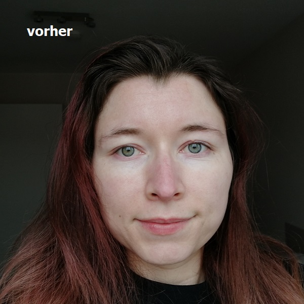 Haut vorher