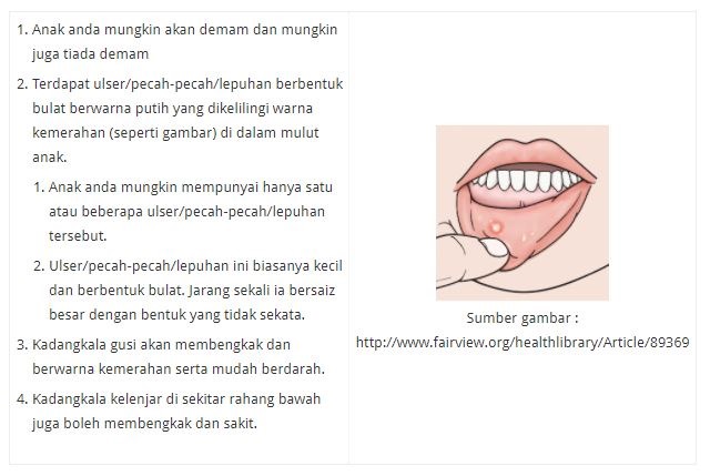 SAKIT MULUT CERITA DEMAM SUHU TINGGI KALI INI (7)