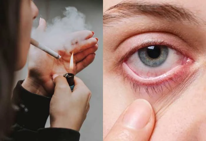 Can smoking affect your eyes?