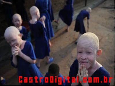 IMAGEM - Acampamento albino