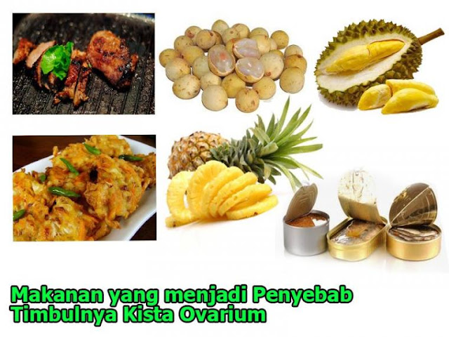 Makanan Penyebab Kista Ovarium