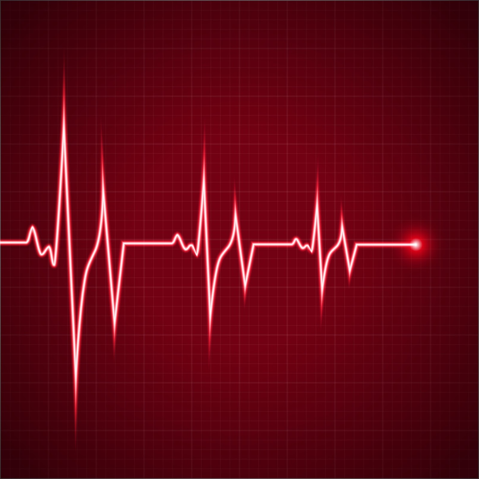 Start Sensor Detak Jantung  SEN 11574 dengan Arduino
