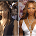 Elise Neal Plastic Surgery